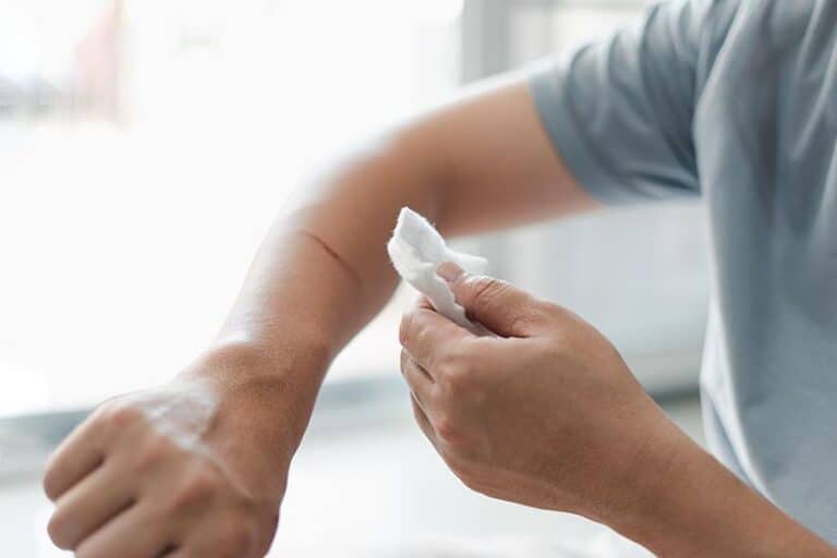 Man with wound on arm. Targeted pain
